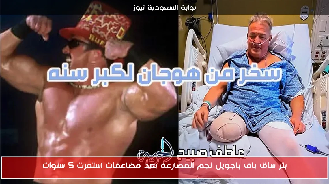 بتر ساق باف باجويل نجم المصارعة بعد مضاعفات استمرت 5 سنوات