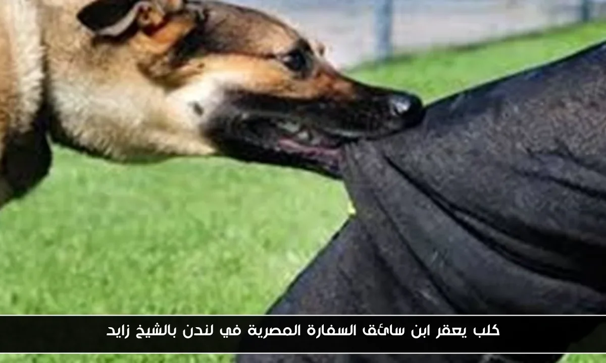 كلب يعقر ابن سائق السفارة المصرية في لندن بالشيخ زايد