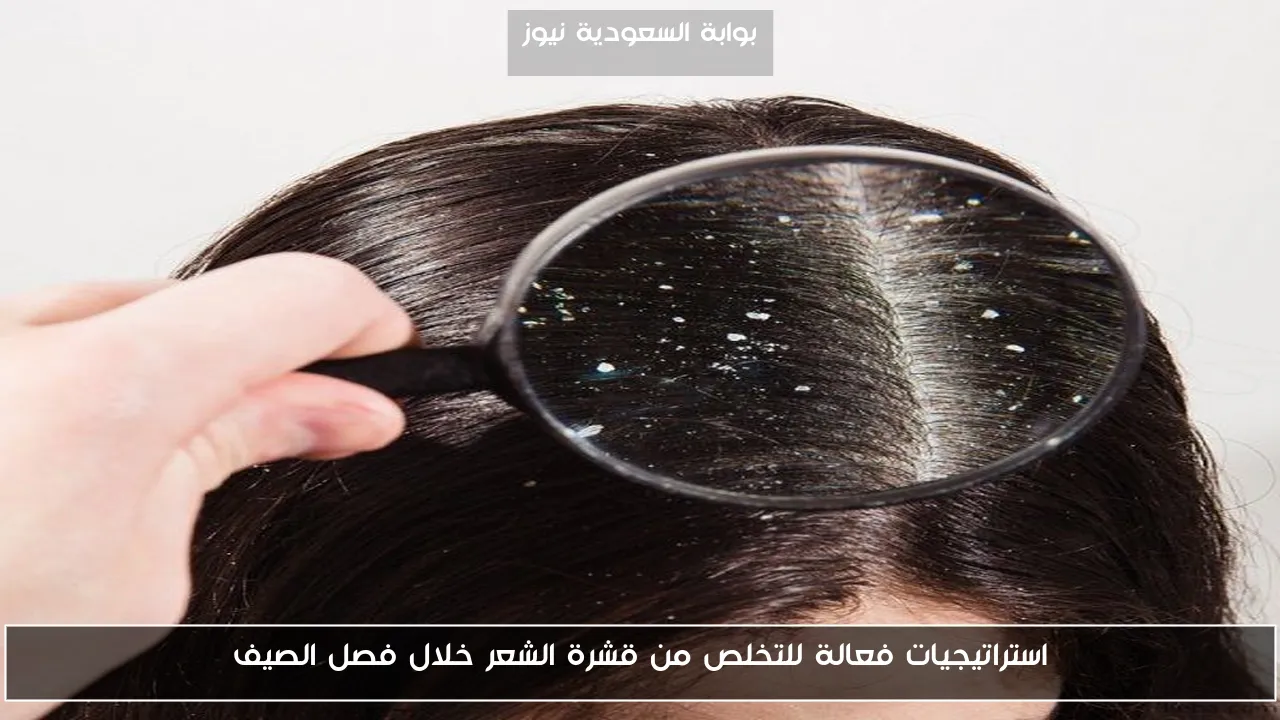 استراتيجيات فعالة للتخلص من قشرة الشعر خلال فصل الصيف