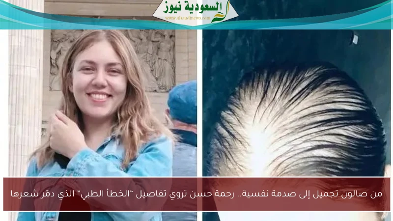 من صالون تجميل إلى صدمة نفسية.. رحمة حسن تروي تفاصيل “الخطأ الطبي” الذي دمّر شعرها