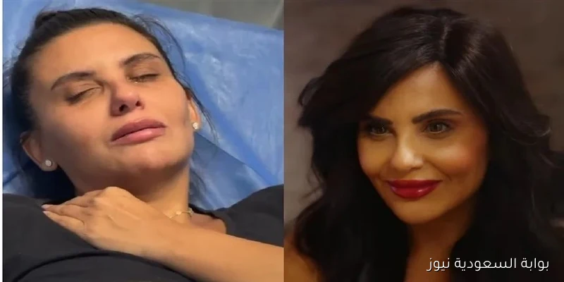 تشوه وجه دانا حمدان يكشف عن مخاطر العيادات التجميلية غير المؤهلة